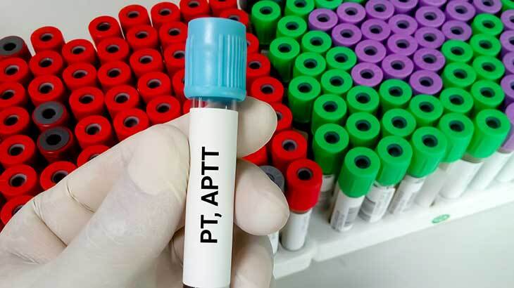 aPTT 