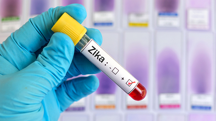 Zika virüsü nedir?